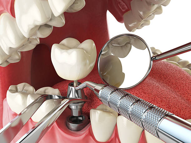 Emergency Dentist Open Today in GA